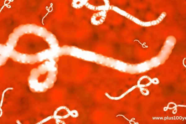 Ebola virus diseases