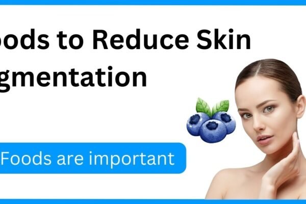 Foods to Reduce Skin Pigmentation