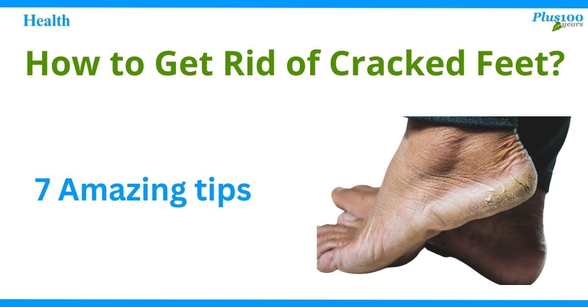 How to Get Rid of Cracked Feet