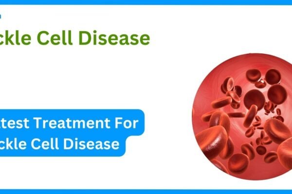 sickle cell disease and latest treatment options