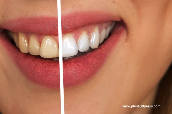 teeth whitening tips 