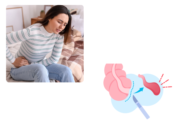 Appendix symptoms in female