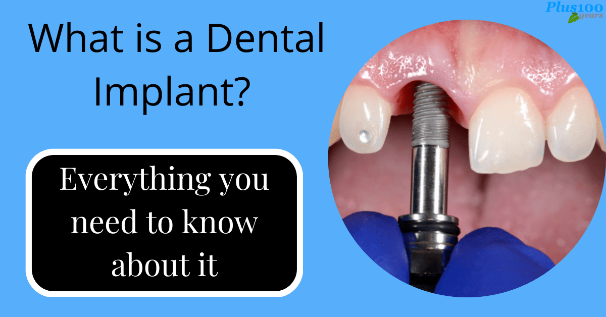 what is dental implant